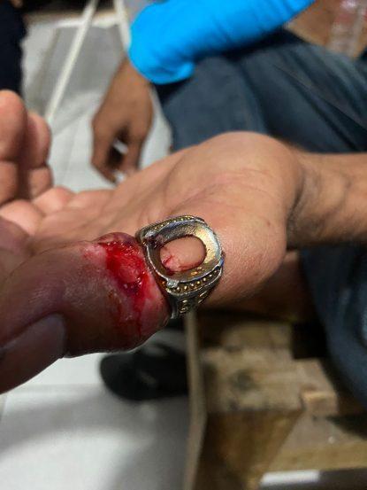 Cincin akik