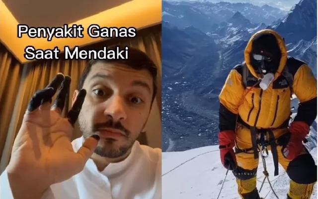 jari pendaki ini menghitam